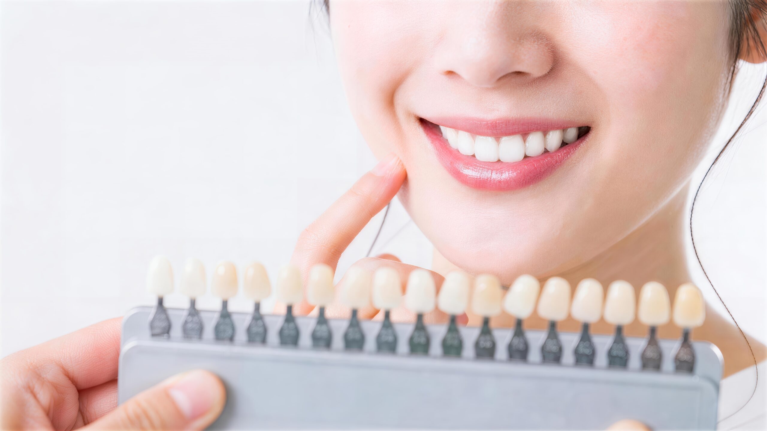 シェードガイドを使用して歯の色を確認する様子